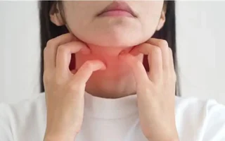 Allergy Control Treatment